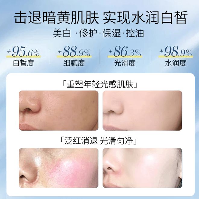 十大公认最好用的面膜肌肤畅快呼吸凯发K8国际面膜哪个牌子最好用？(图3)