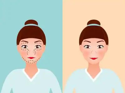 项目比较好？几天见效术后案例医院凯发k8登录想要眼部提升做什么(图2)