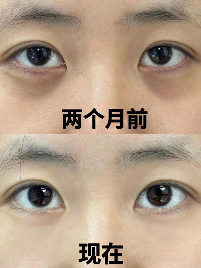 绿管眼霜效果、肤感一流的眼霜解析K8凯发登录广受好评的初源漾小(图6)