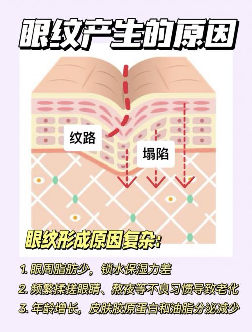 ？25年淡纹眼霜选择指南五款详细分享k8凯发国际入口什么眼霜去皱效果好(图9)